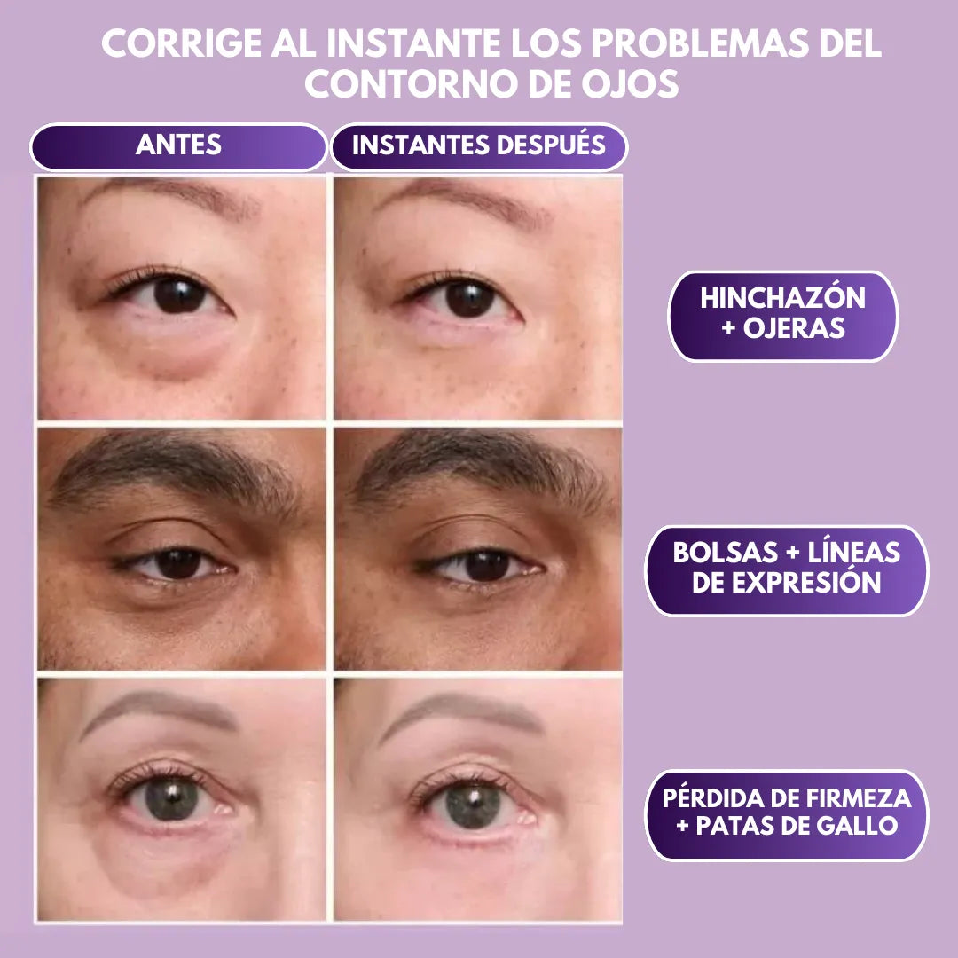 EternaGaze™ Reafirmante Instantáneo de Ojos
