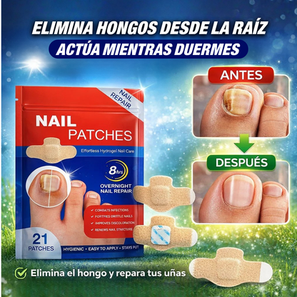 DermaPatch™ Parche Antifúngico para Hongo UPSELL