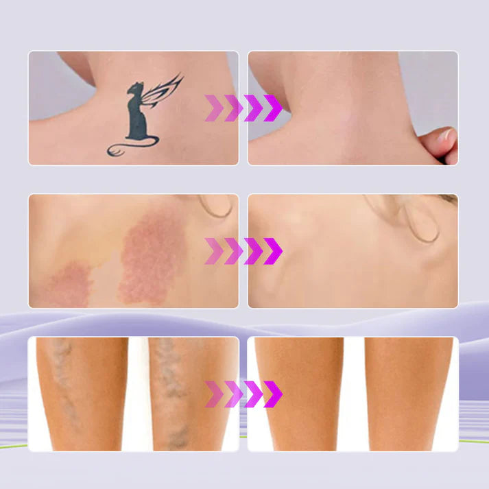 EELHOE™ - Corrector Hidratante corporal Tono Claro