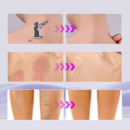 EELHOE™ - Corrector Hidratante corporal Tono Claro