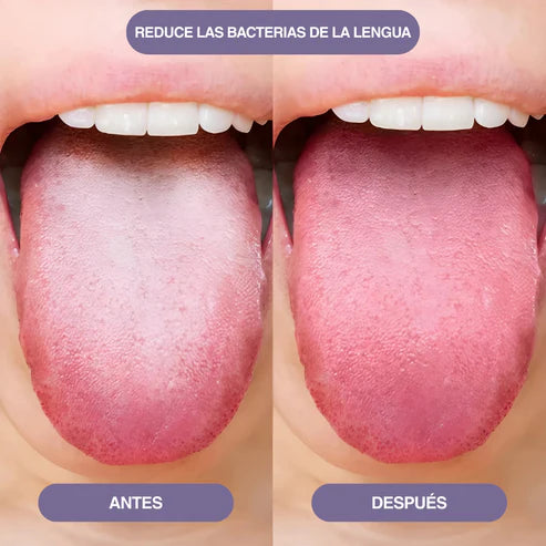 FreshBio™ Spray Oral Para Mal Aliento