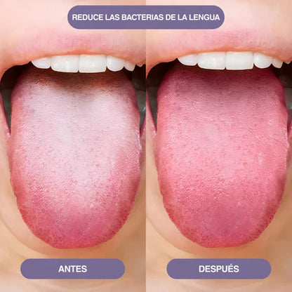 FreshBio™ Spray Oral Para Mal Aliento